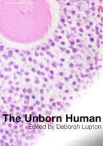 Thumbnail for File:Unborn human 3.jpg